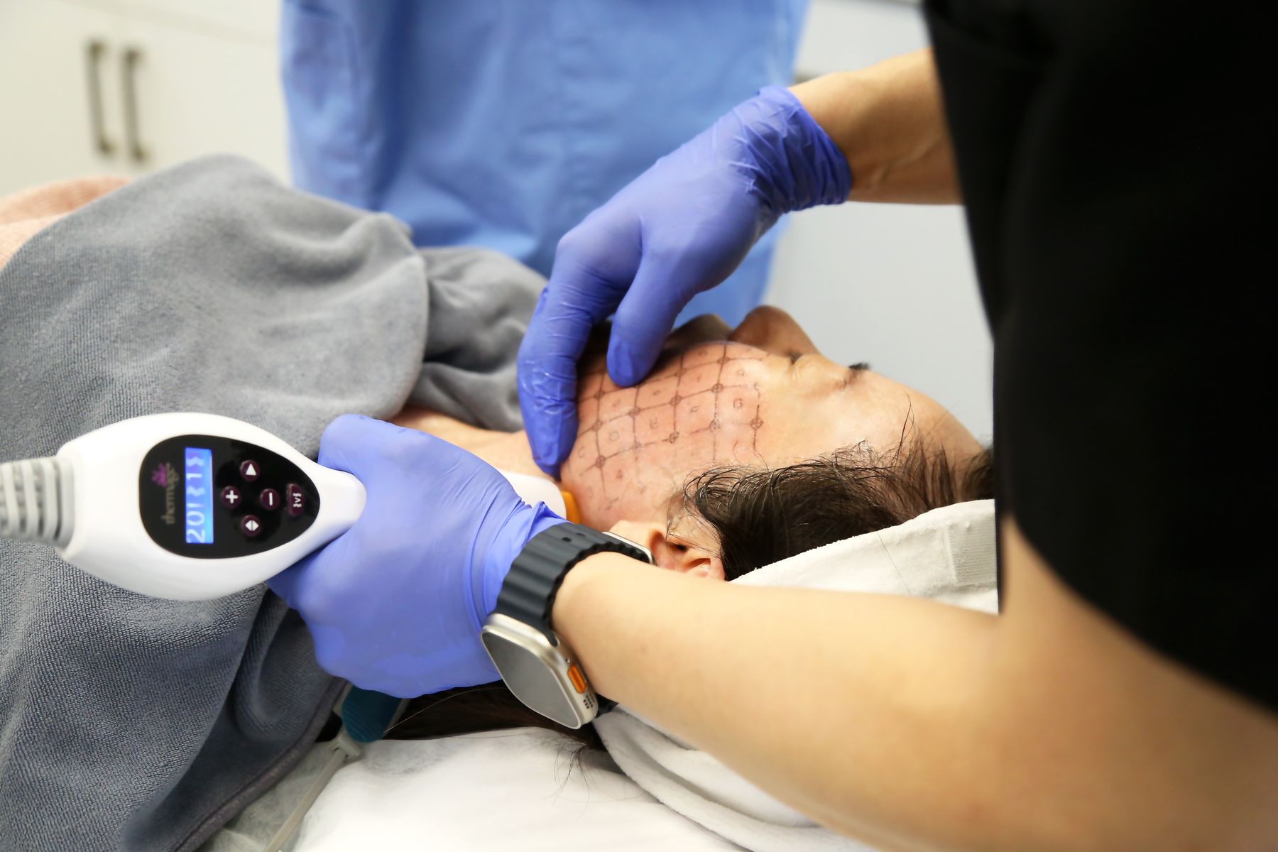 Thermage treatment at Lidy Beauty